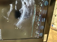 Ultrasonograf Vivid S6 2014r z głowicą M4S RS z 2023 r